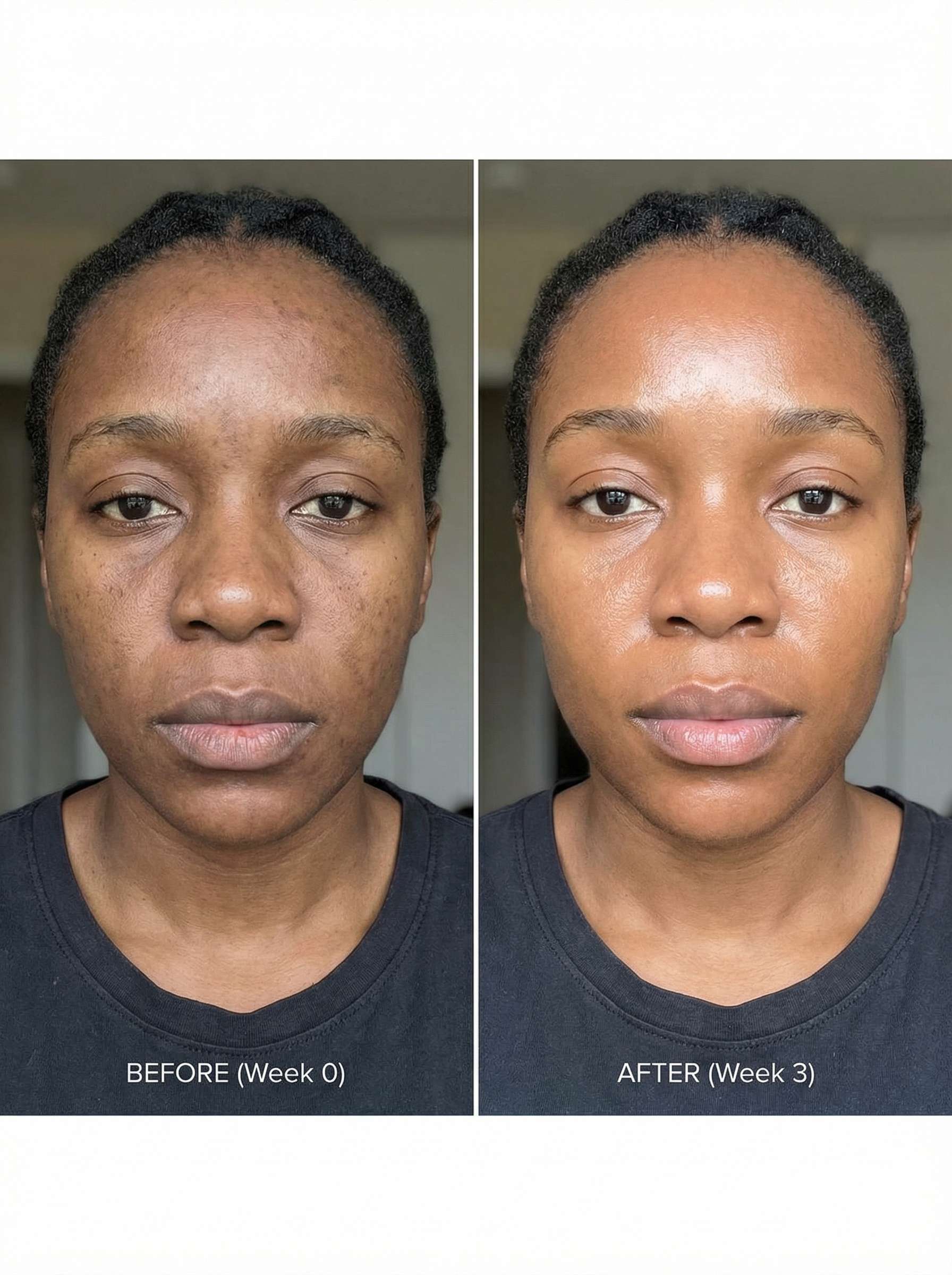 Before and after skin transformation